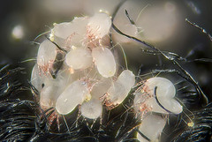 House dust mites in cluster